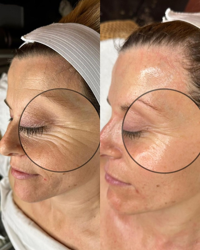 Comparación visual del aspecto de la piel del rostro